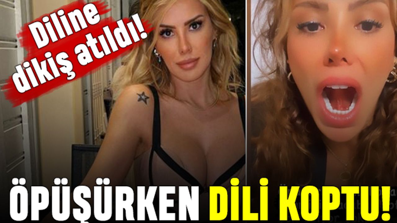 Öpüşürken dili kopan Ceyda Ersoy: Sapık mıdır nedir anlamadım