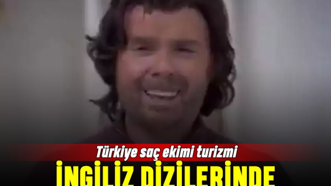 Türkiye saç ekimi turizmi dünyanın gündeminde