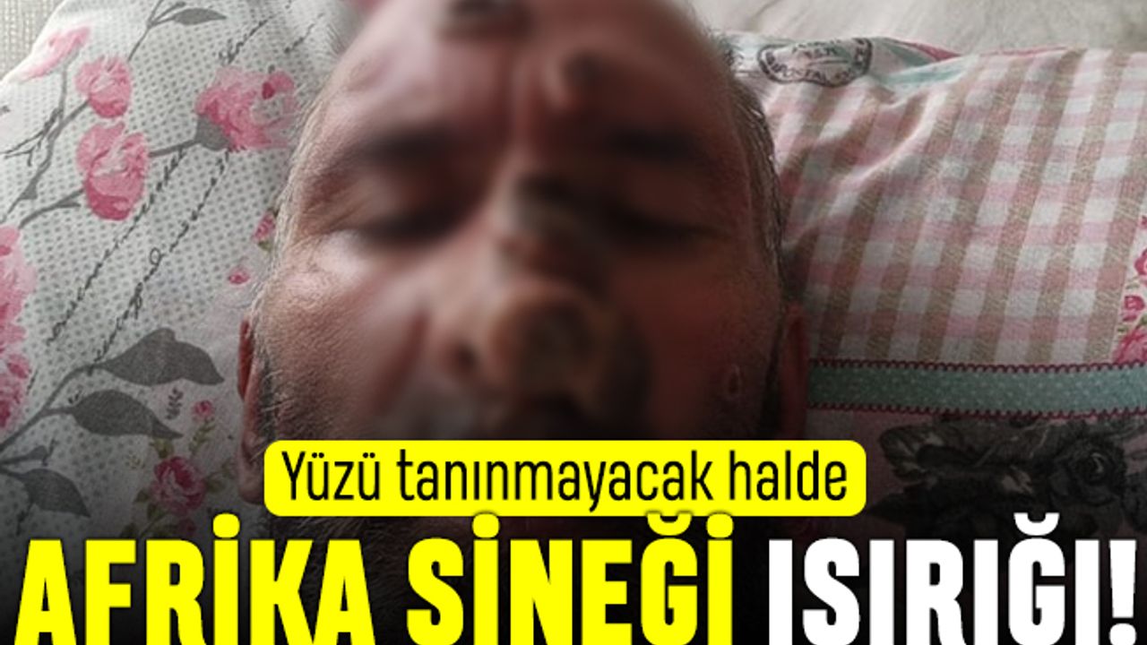 Afrika Sineği ısırığıyla yüzü tanımayacak halde; Afrika Sineği nedir?