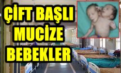 ÇİFT BAŞLI MUCİZE BEBEKLER