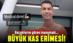 Bu nasıl bir kas erimesi? Ronaldo'nun bacaklarını gören inanamadı