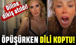 Öpüşürken dili kopan Ceyda Ersoy: Sapık mıdır nedir anlamadım
