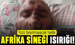 Afrika Sineği ısırığıyla yüzü tanımayacak halde; Afrika Sineği nedir?