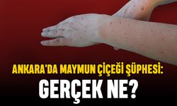 Ankara'da Maymun Çiçeği Şüphesi: Gerçek Ne?