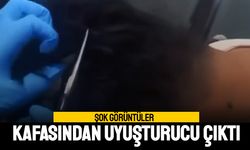 Şok görüntüler; Kafasından uyuşturucu madde çıktı