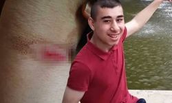 Beylikdüzü'nde Bir Bakımevinde 21 Yaşındaki Gence '30 Kat Fazla İlaç' Verildiği Ortaya Çıktı