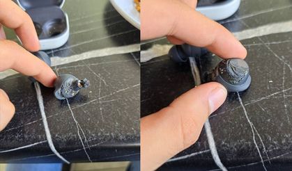 Kulaklık kulağında patladı; Kullanıcı hakkını sosyal medyada arıyor