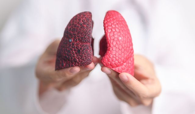 Türkiye’nin Kanser Haritası Güncellendi: En Yüksek Oran Ağrı’da