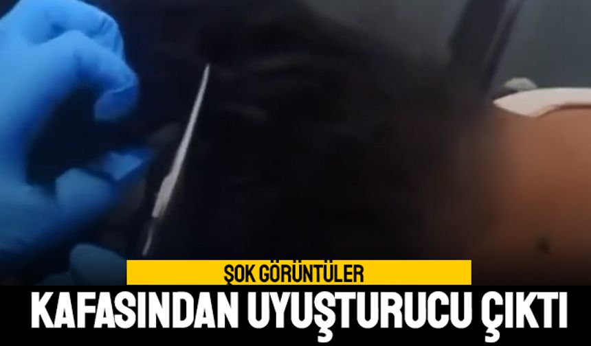 Şok görüntüler; Kafasından uyuşturucu madde çıktı