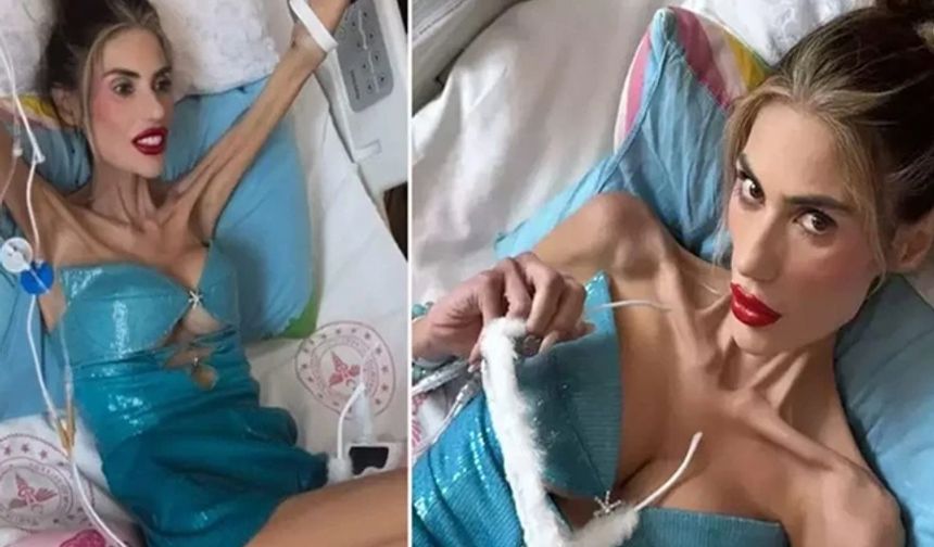 Nihal Candan'ı öldüren aşırı zayıflık Anoreksiya nedir, psikolojik hastalık mı?
