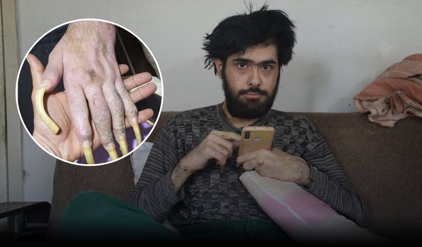 Deprem Sonrası Hayata Küsen Genç: “Hiçbir Hayalim Yok, Hiçbir Şey Olmasını İstemiyorum”