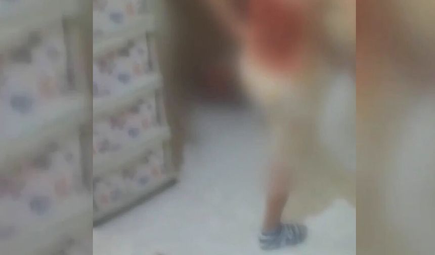 İstanbul’da Dehşete Düşüren Akran Zorbalığı: 12 Yaşındaki Çocuğu Kolonya Döküp Yaktılar!